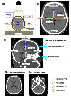 The effects of distance between the imaging isocenter and brain center on the image quality of cone-beam computed tomography for brain stereotactic irradiation.