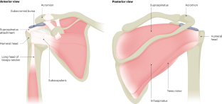 Rotator cuff tears.