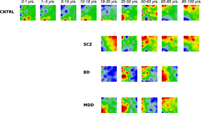 Temporal changes of gene expression in health, schizophrenia, bipolar disorder, and major depressive disorder