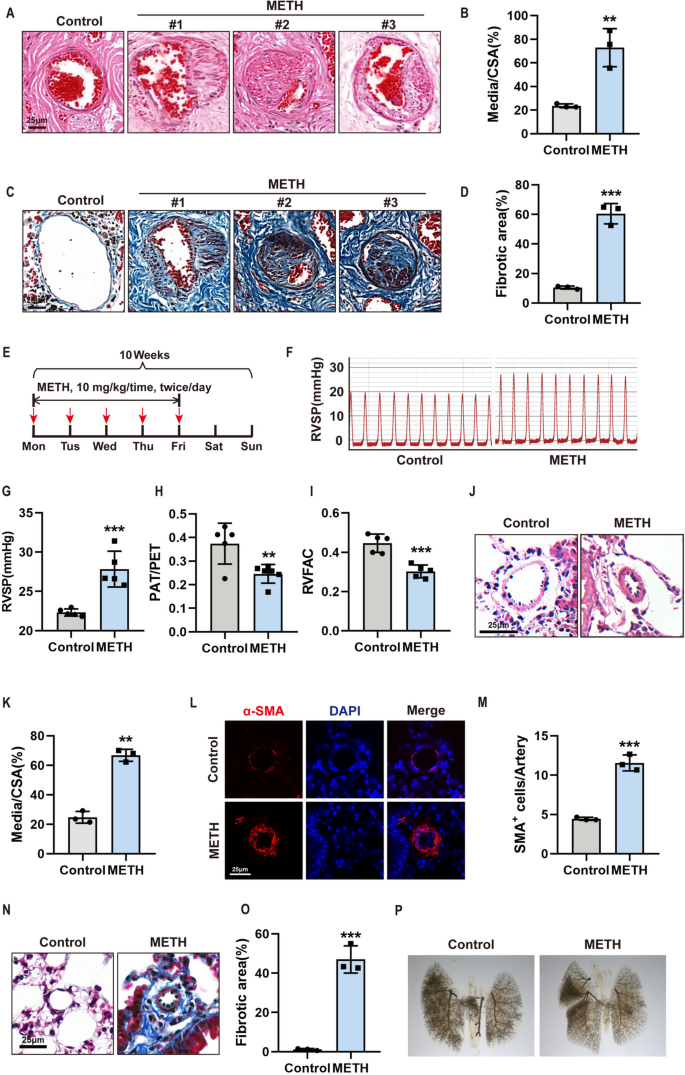 Nupr1-mediated vascular smooth muscle cell phenotype transformation involved in methamphetamine induces pulmonary hypertension.