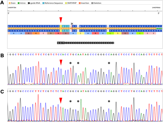 CRISPR/Cas9-mediated knock-in cells of the late-onset Alzheimer’s disease-risk variant, SHARPIN G186R, reveal reduced NF-κB pathway and accelerated Aβ secretion