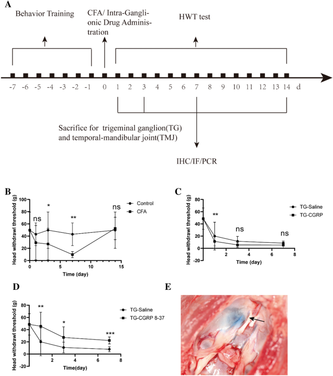 Expression of CGRP in the Trigeminal Ganglion and Its Effect on the Polarization of Macrophages in Rats with Temporomandibular Arthritis.