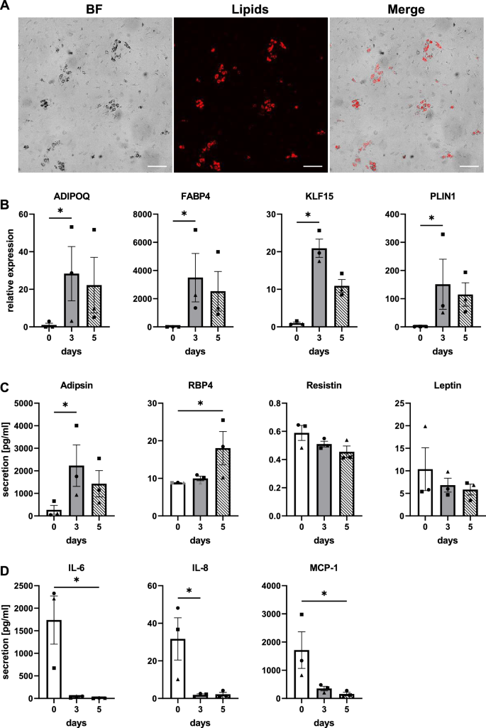 Reconstructed Human Skin with Hypodermis Shows Essential Role of Adipose Tissue in Skin Metabolism