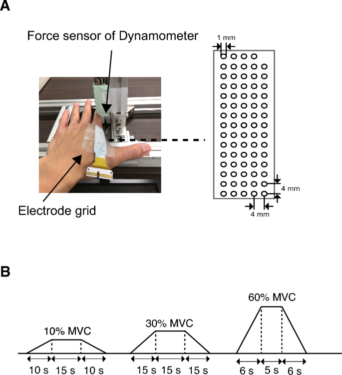 Sex differences in laterality of motor unit firing behavior of the first dorsal interosseous muscle in strength-matched healthy young males and females.