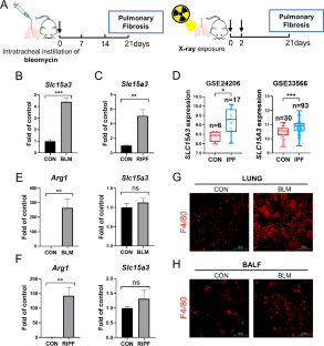 SLC15A3 plays a crucial role in pulmonary fibrosis by regulating macrophage oxidative stress