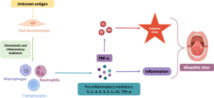 Systemic and local effect of oxidative stress on recurrent aphthous stomatitis: systematic review.