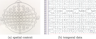 MMA: metadata supported multi-variate attention for onset detection and prediction