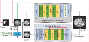 Low-Dose CT Image Super-resolution Network with Noise Inhibition Based on Feedback Feature Distillation Mechanism.