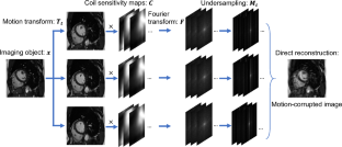 Stop moving: MR motion correction as an opportunity for artificial intelligence