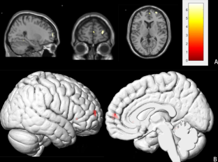 Structural and functional changes following brain surgery in pediatric patients with intracranial space-occupying lesions.