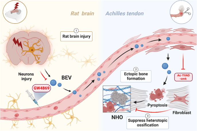 Interorgan communication in neurogenic heterotopic ossification: the role of brain-derived extracellular vesicles.