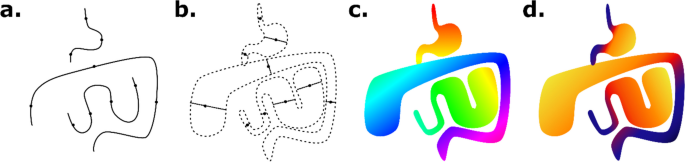 Towards an EKG for SBO: A Neural Network for Detection and Characterization of Bowel Obstruction on CT.