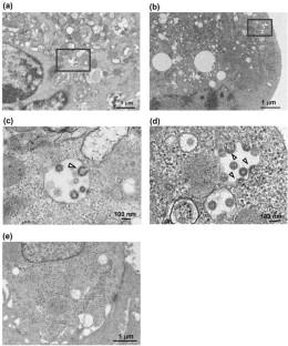 Morphological analysis for two types of viral particles in vacuoles of SARS-CoV-2-infected cells.