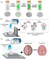 Futuristic Alzheimer's therapy: acoustic-stimulated piezoelectric nanospheres for amyloid reduction†
