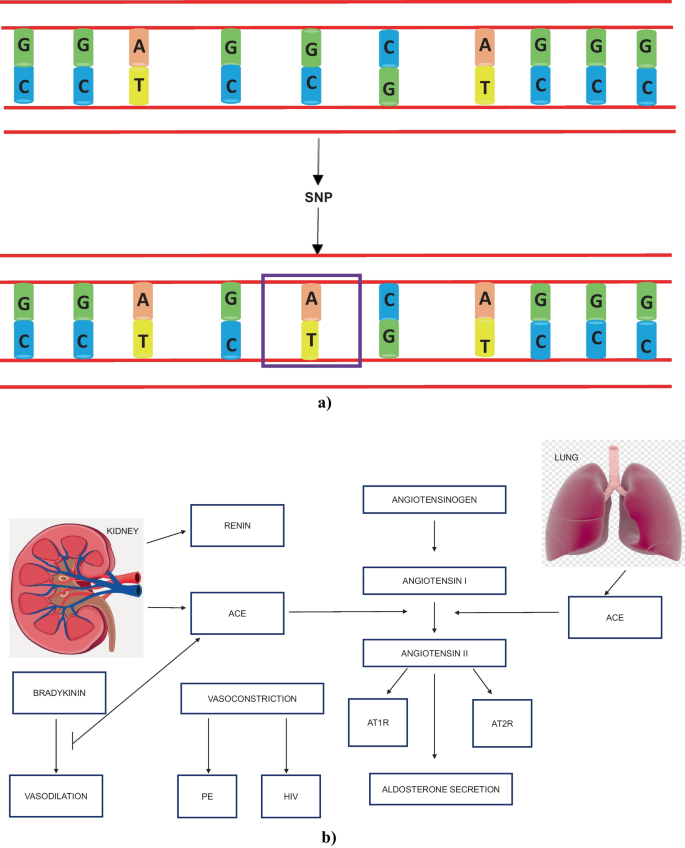 Genetic Appraisal of RAAS-Associated SNPs: REN (rs16853055), AGT (rs3789678) and ACE (rs4305) in Preeclamptic Women Living with HIV Infection.