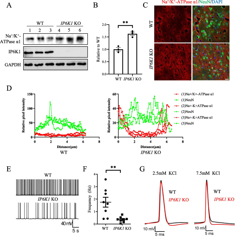 Deleting IP6K1 stabilizes neuronal sodium-potassium pumps and suppresses excitability.