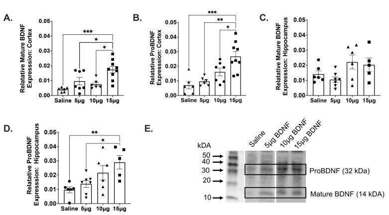 Intranasal Administration of BDNF Improves Recovery and Promotes Neural Plasticity in a Neonatal Mouse Model of Hypoxic Ischemia.