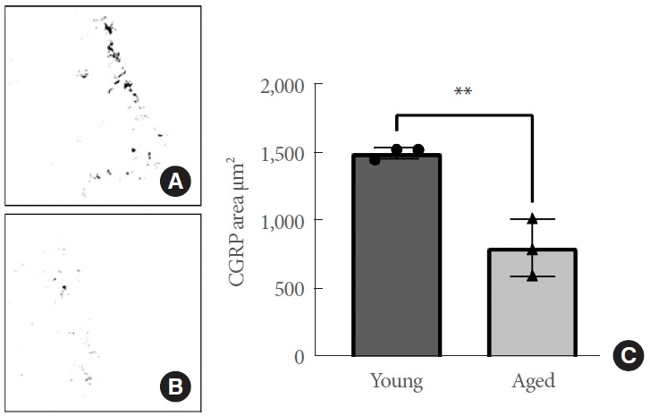 Quantification of Aging-Related Decreases in Sensory Innervation of the Bladder Trigone in Rats.