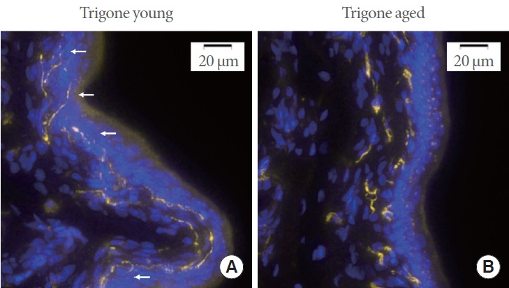 Quantification of Aging-Related Decreases in Sensory Innervation of the Bladder Trigone in Rats.