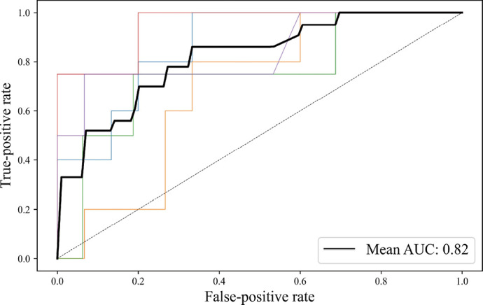 Anxiety evaluated by the Hospital Anxiety and Depression Scale as a predictor of postoperative nausea and vomiting: a pilot study.