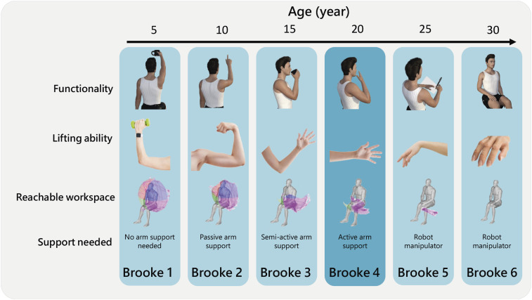 Design requirements of upper extremity supports for daily use in Duchenne muscular dystrophy with severe muscle weakness.