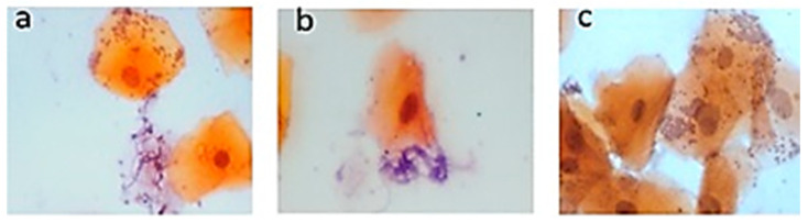 <i>Candida</i> Variety in the Oral Cavity of Mexican Subjects with Type 2 Diabetes Mellitus and TLR2 Gene Expression.