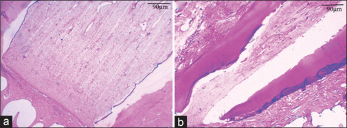 Morphometric parameters of dental pulp in immature teeth in a sheep model after mechanical pulp exposure and restoration with reinforced zinc oxide-eugenol.