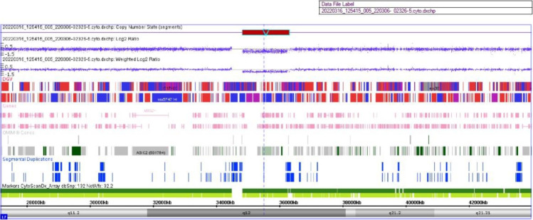The first case of hyperosmolar diabetic ketoacidosis in a patient diagnosed with MODY 5 (maturity-onset diabetes of the young type 5) and 17q12 microdeletion syndrome.