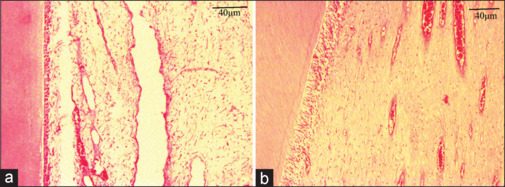 Morphometric parameters of dental pulp in immature teeth in a sheep model after mechanical pulp exposure and restoration with reinforced zinc oxide-eugenol.
