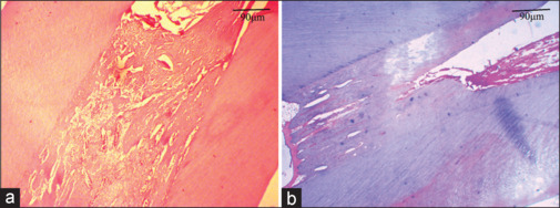 Morphometric parameters of dental pulp in immature teeth in a sheep model after mechanical pulp exposure and restoration with reinforced zinc oxide-eugenol.