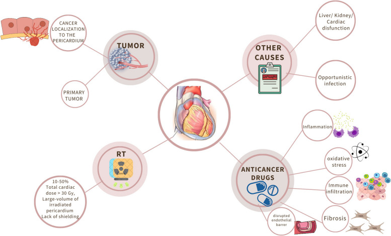 Pericardial effusion in oncological patients: current knowledge and principles of management.