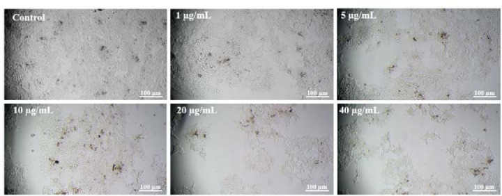 The effects of chitosan-loaded JQ1 nanoparticles on OVCAR-3 cell cycle and apoptosis-related gene expression.