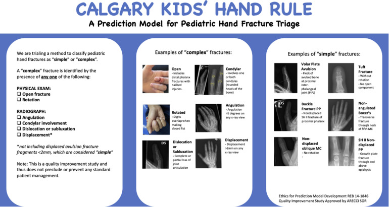 Prospective Validation of the <i>Calgary Kids' Hand Rule</i>: A Clinical Prediction Rule for Pediatric Hand Fracture Triage.