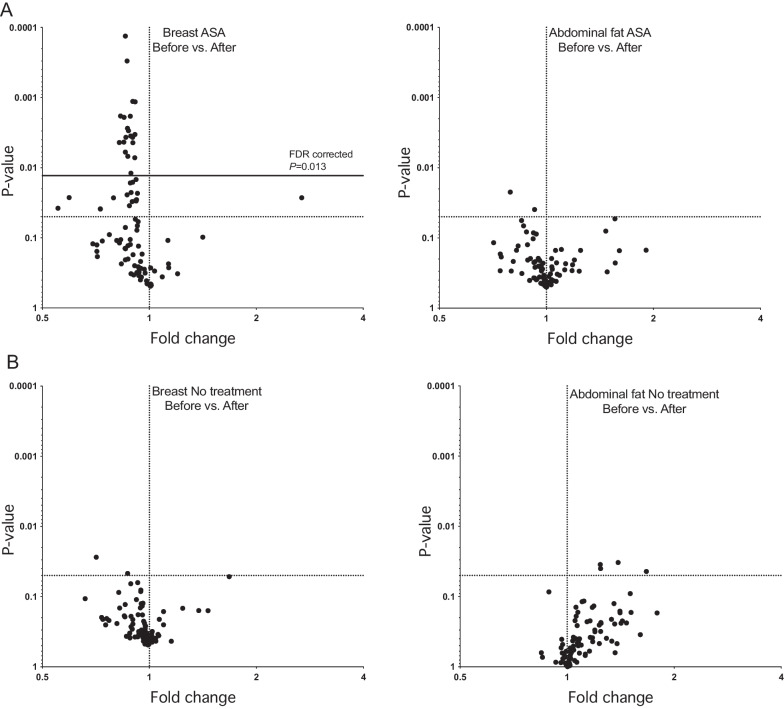 Low-dose acetylsalicylic acid reduces local inflammation and tissue perfusion in dense breast tissue in postmenopausal women.