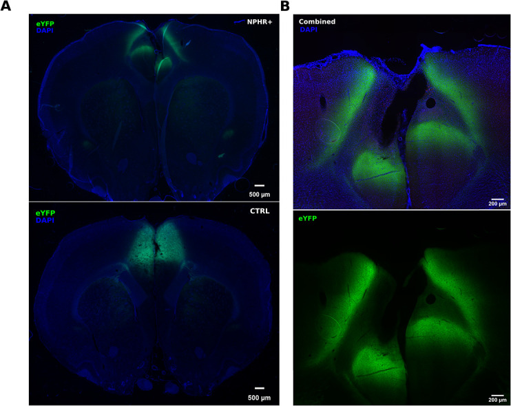 Effects of optogenetic silencing the anterior cingulate cortex in a delayed non-match to trajectory task.