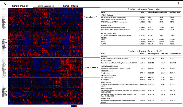 TROP-2, NECTIN-4 and predictive biomarkers in sarcomatoid and rhabdoid bladder urothelial carcinoma.