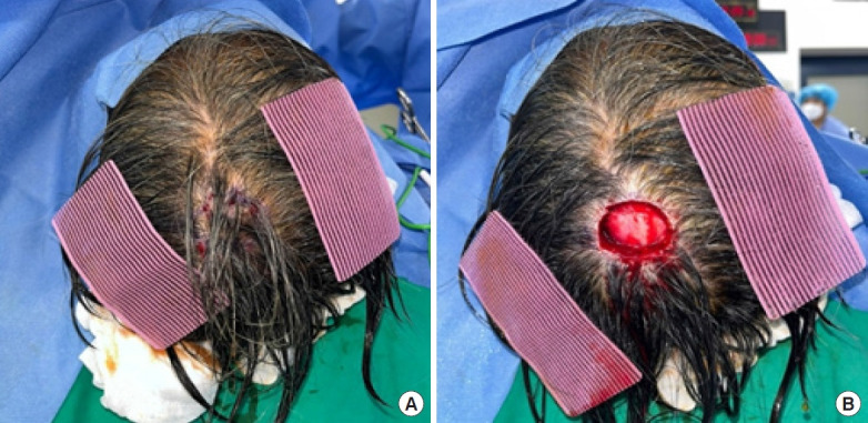 Fixing hair using a hair-fixing sheet: better than hairpins?