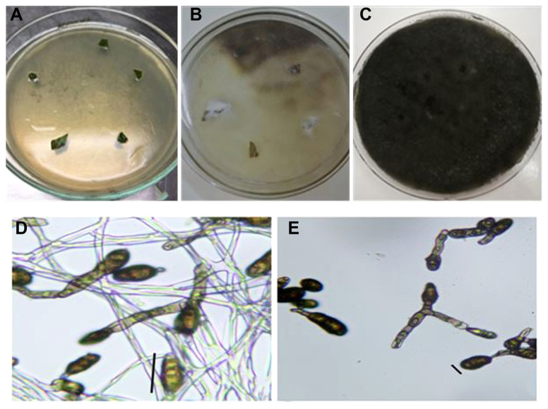 Assessment of Resistance Induction in Mungbean against Alternaria alternata through RNA Interference.