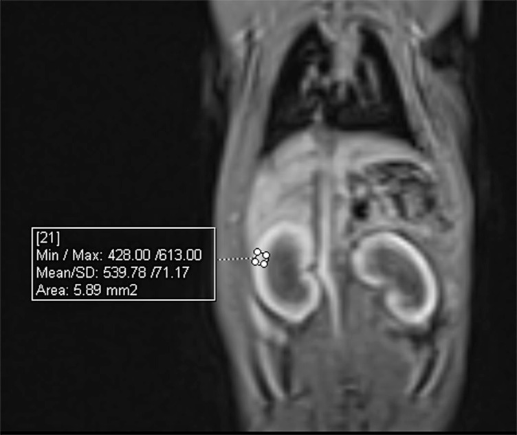 Temporal Assessment of Gadolinium Deposition and T1 Signal Intensity Changes in Rat Kidney with Single and Multiple Doses of Injection: An Experimental Study.