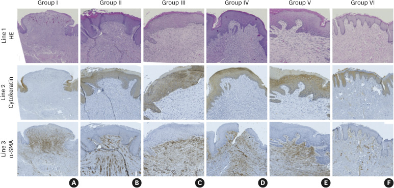 Bacterial cellulose matrix and acellular dermal matrix seeded with fibroblasts grown in platelet-rich plasma supplemented medium, compared to free gingival grafts: a randomized animal study.