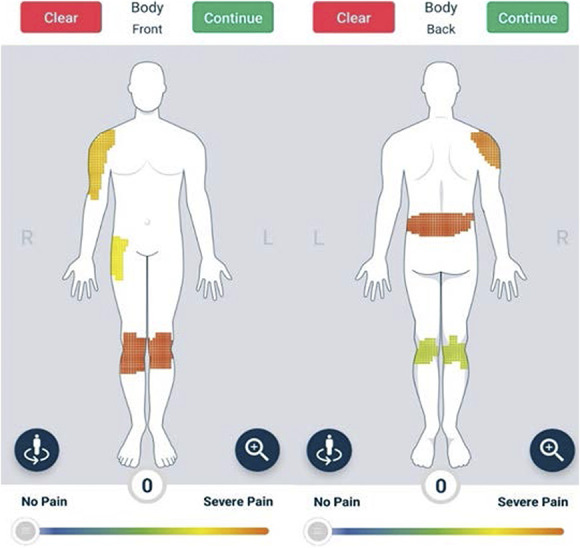 Reliability, validity, and responsiveness of a smartphone-based manikin to support pain self-reporting.