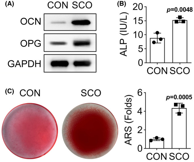 Scopolamine regulates the osteogenic differentiation of human periodontal ligament stem cells through lactylation modification of RUNX2 protein.