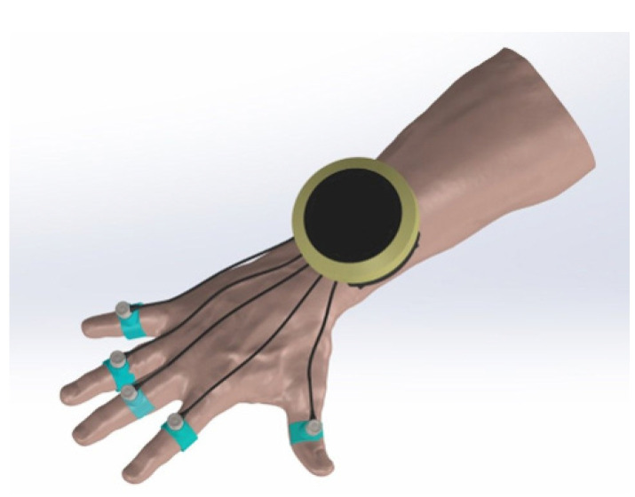 Efficacy and Safety of High Density LED Irradiation Therapy for Patients With Hand Osteoarthritis: A Single-Center Clinical Study.