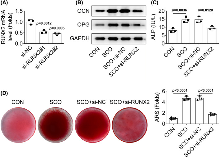Scopolamine regulates the osteogenic differentiation of human periodontal ligament stem cells through lactylation modification of RUNX2 protein.