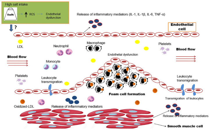 Dietary Salt Can Be Crucial for Food-Induced Vascular Inflammation.