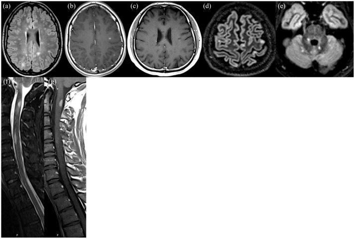 Prognostic relevance of MRI in early relapsing multiple sclerosis: ready to guide treatment decision making?