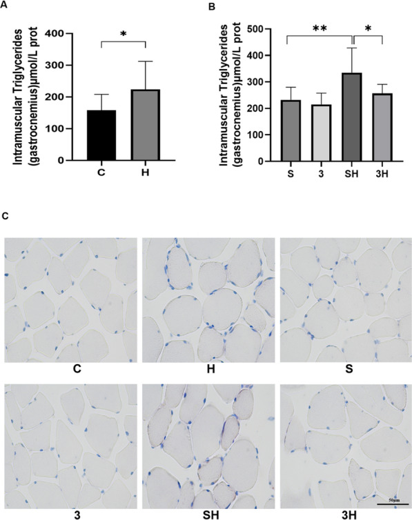 The role of GPR81-cAMP-PKA pathway in endurance training-induced intramuscular triglyceride accumulation and mitochondrial content changes in rats.