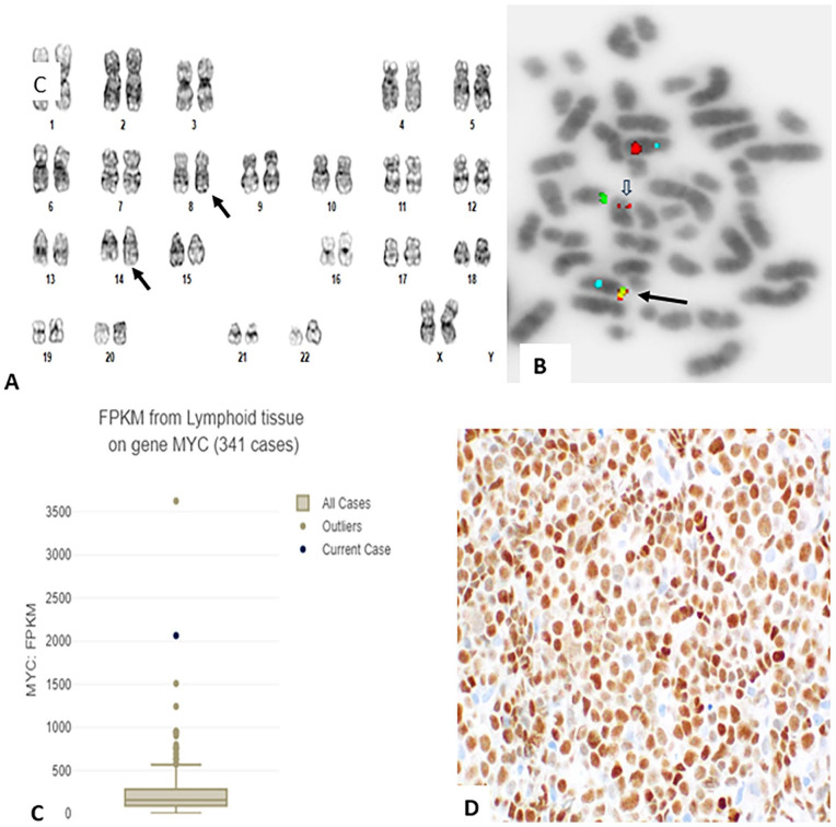 RNASeq Analysis for Accurate Identification of Fusion Partners in Tumor Specific Translocations Detected by Standard FISH Probes in Hematologic Malignancies.