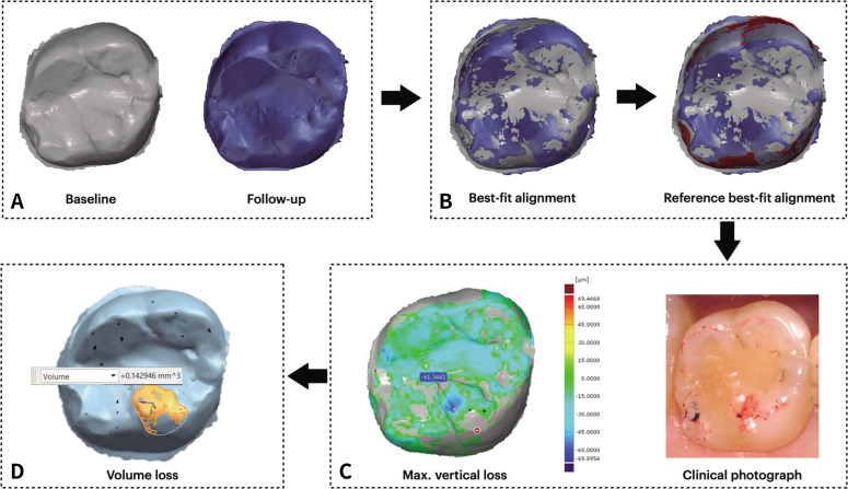 3D quantitative analysis and SEM qualitative analysis of natural antagonist enamel opposing CAD-CAM monolithic zirconia or lithium disilicate tooth-supported crowns versus enamel opposing natural enamel.