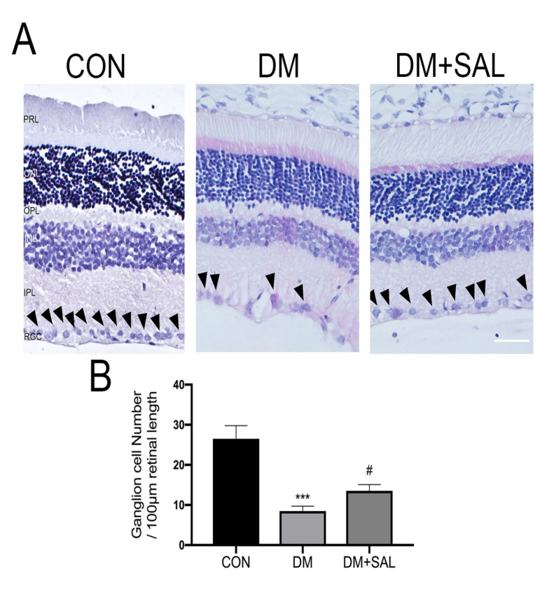 Salidroside ameliorates diabetic retinopathy and Müller cell inflammation via the PI3K/Akt/GSK-3β/NF-𝜅B pathway.